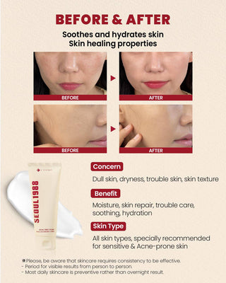 KSECRET Seoul 1988 CREAM: Snail Mucin 93% + Rice 100mL - Kbeauty Canada