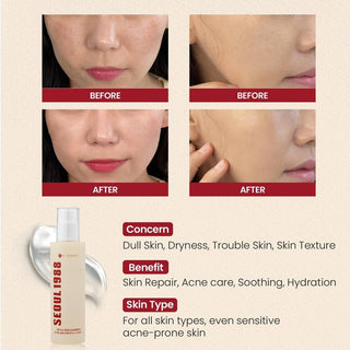 KSECRET Seoul 1988 ESSENCE: Snail Mucin 97% + Rice 100mL - Kbeauty Canada