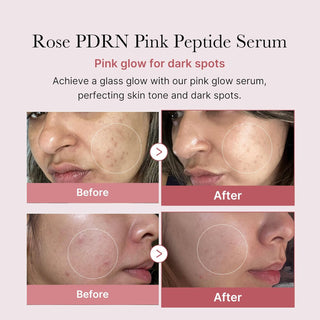 MEDICUBE PDRN Pink Peptide Serum 30mL - Kbeauty Canada