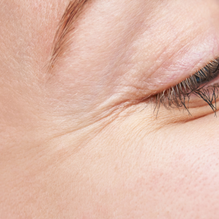 Wrinkles