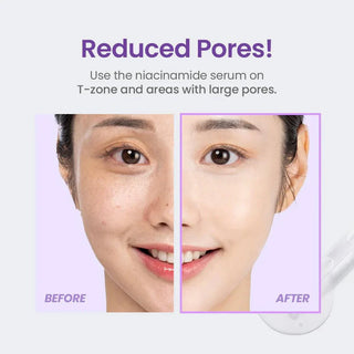 TIRTIR Niacinamide 20% Serum 30mL - Kbeauty Canada