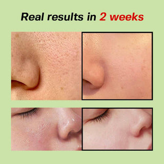 SUNGBOON EDITOR Green Tomato Pore Lifting Ampoule 30mL (Buy One Get One Free) - Kbeauty Canada