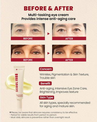 KSECRET Seoul 1988 Eye Cream: Retinal Liposome 4% + Fermented Bean 30mL - Kbeauty Canada