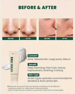 KSECRET Seoul 1988 Cleansing Foam: Pine Cica 1% + Probiotics 150mL - Kbeauty Canada