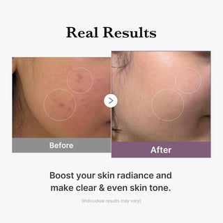 MEDICUBE Age-R Glutathione Glow Toner 140mL - Kbeauty Canada
