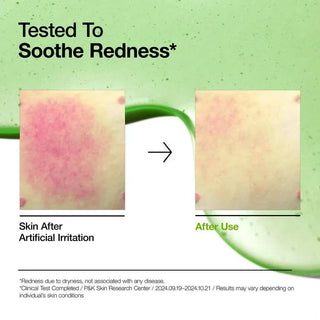 ANUA Azelaic Acid 10 Hyaluron Redness Soothing Serum 30mL - Kbeauty Canada