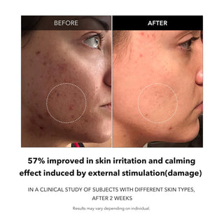 APRIL SKIN Carrotene Clarifying Serum 37mL