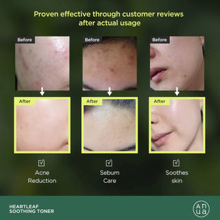 Anua Heartleaf 77 Soothing Toner 250 ml – Face Toner for Sensitive Skin