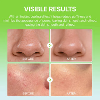 Dr.Melaxin Cactox Pore Relief Multi Balm 25g - Kbeauty Canada