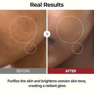 Dr.Melaxin PEEL SHOT GLOW RICE TONER 200ML - Kbeauty Canada