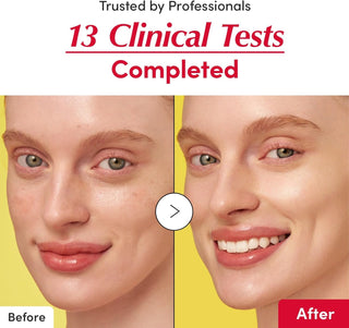 EQQUALBERRY Vitamin Illuminating Serum 30mL - Kbeauty Canada