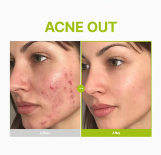 PURITO SEOUL Azelaic Acid 10 Kojic Azulene Serum 30ml