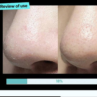ILSO Super Melting Serum Softner 150mL - Kbeauty Canada