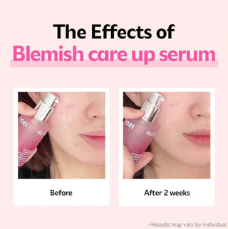 ISOI Blemish Care Up Serum 35mL
