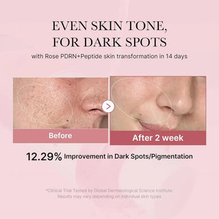 MEDICUBE PDRN Pink Niacinamide Milky Toner 150mL - Kbeauty Canada
