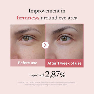 MEDICUBE PDRN Pink Peptide Eye Cream 30mL - Kbeauty Canada