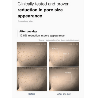 MEDICUBE Zero Pore One Day Serum 30mL - Kbeauty Canada