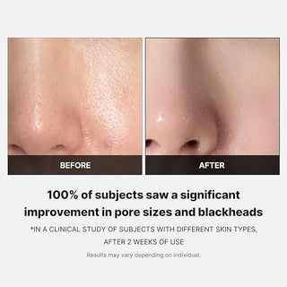 MEDICUBE Zero Pore Pad (70pcs) - Kbeauty Canada