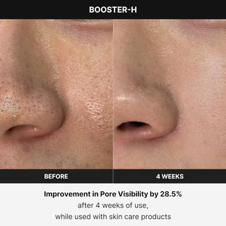 Medicube Age-R Booster Pro EX - Kbeauty Canada