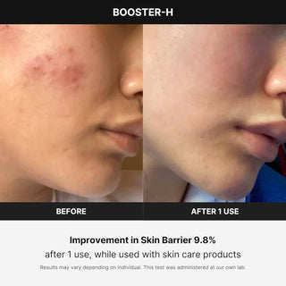 Medicube Age-R Booster Pro EX - Kbeauty Canada