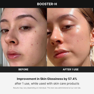 Medicube Age-R Booster Pro EX - Kbeauty Canada
