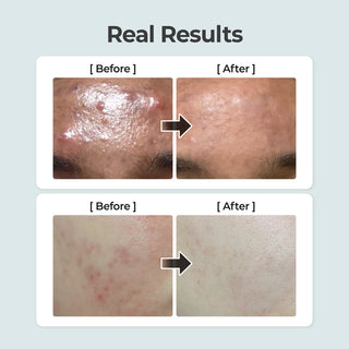 Numbuzin No.1 Pure-Full Calming Herb Toner (300ml) - Kbeauty Canada