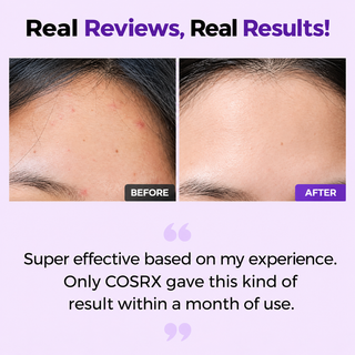 COSRX AHA/BHA Clarifying Treatment Toner in a clear bottle, designed for pore tightening and skin exfoliation.