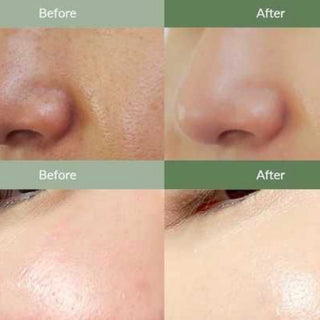 Dr. Althea Premium Quick Step Sebum Cleanser in 100ml bottle, featuring clear liquid and pump dispenser for oily skin cleansing.