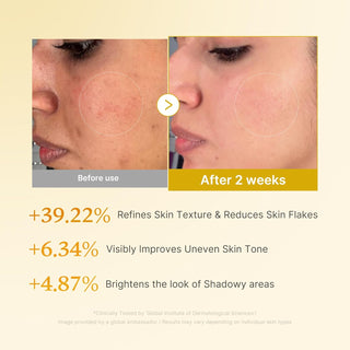 Medicube Kojic Acid Turmeric Resurfacing Toner in a 250mL bottle, showing the clear liquid and label with product details.