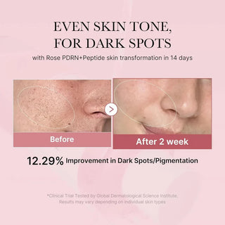 Medicube PDRN Pink Niacinamide Milky Toner in a 150mL bottle, showing the soft pink liquid inside a clear bottle with a white cap.