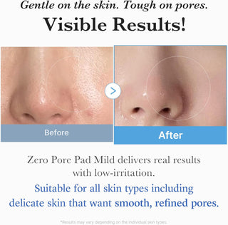 Medicube Zero Pore Pad Mild toner pads in a box of 70, showing soft cotton pads for pore care and gentle exfoliation.