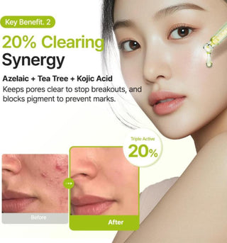 Purito Seoul Azelaic Acid 10% Kojic Tea Tree Serum 30ml bottle with pump dispenser, clear label, and white cap.
