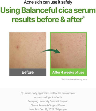 Torriden Balanceful Cica Serum 50mL bottle with pump dispenser, clear liquid inside, designed for soothing and nourishing skin.